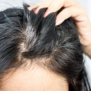 利尻ヘアカラートリートメントの注意点