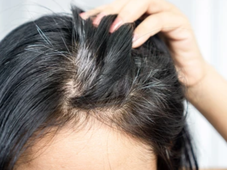 利尻ヘアカラートリートメントの注意点